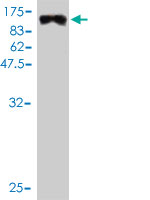 WB - MYBPH Antibody (monoclonal) (M01) AT2945a
