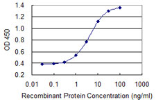 E - MYOZ1 Antibody (monoclonal) (M05) AT2965a