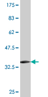 WB - MYOZ1 Antibody (monoclonal) (M05) AT2965a