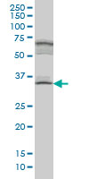 WB - MYOZ1 Antibody (monoclonal) (M05) AT2965a