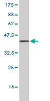 WB - MYT1 Antibody (monoclonal) (M02) AT2967a