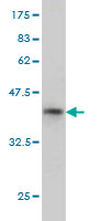 WB - NAT2 Antibody (monoclonal) (M01) AT2973a