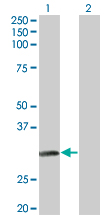 WB - NAT2 Antibody (monoclonal) (M01) AT2973a