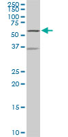 WB - NDOR1 Antibody (monoclonal) (M01) AT2990a