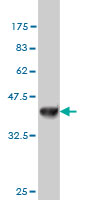 WB - NDST3 Antibody (monoclonal) (M01) AT2997a