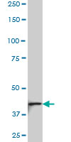 WB - NDST3 Antibody (monoclonal) (M01) AT2997a