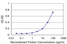 E - NUDT4 Antibody (monoclonal) (M08) AT3132a