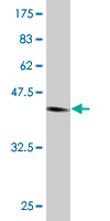 WB - NUDT4 Antibody (monoclonal) (M08) AT3132a