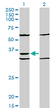 WB - PAX9 Antibody (monoclonal) (M03) AT3195a