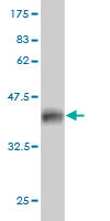 WB - PFN2 Antibody (monoclonal) (M04) AT3274a