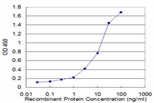 E - PFN2 Antibody (monoclonal) (M05) AT3275a