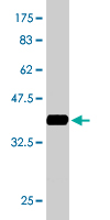WB - PFN2 Antibody (monoclonal) (M05) AT3275a