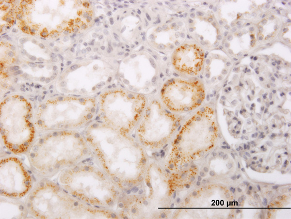 IHC - PHACS Antibody (monoclonal) (M02) AT3291a