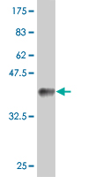 WB - PHACS Antibody (monoclonal) (M02) AT3291a