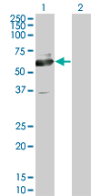 WB - PHACS Antibody (monoclonal) (M02) AT3291a