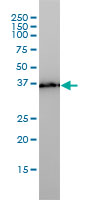 WB - PL6 Antibody (monoclonal) (M01) AT3326a