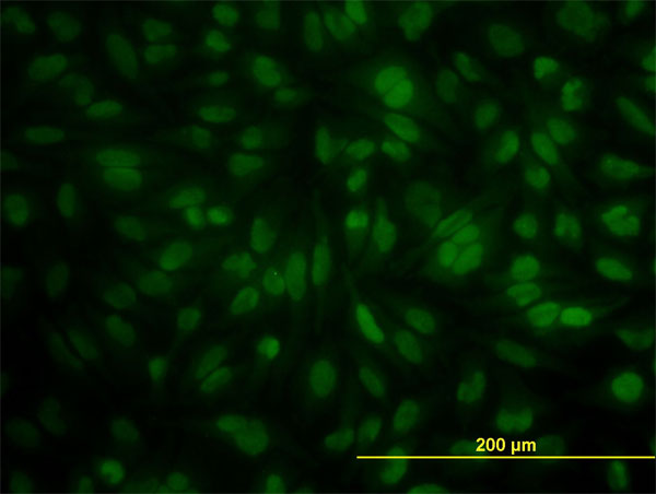 IF - POGK Antibody (monoclonal) (M01) AT3364a