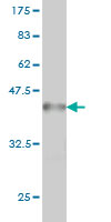 WB - POGK Antibody (monoclonal) (M01) AT3364a