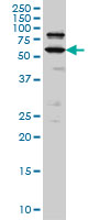 WB - POGK Antibody (monoclonal) (M01) AT3364a