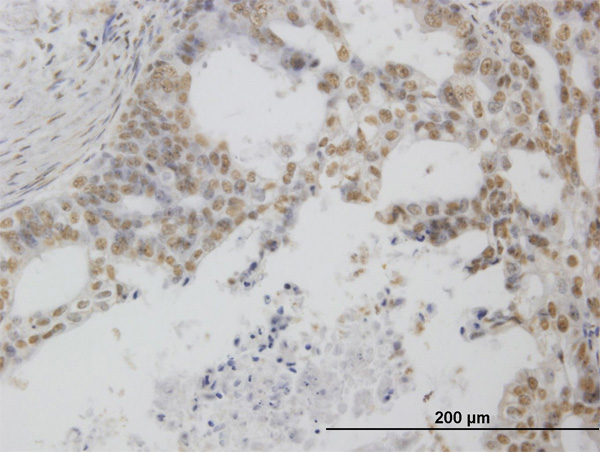 IHC - POLR1C Antibody (monoclonal) (M05) AT3373a