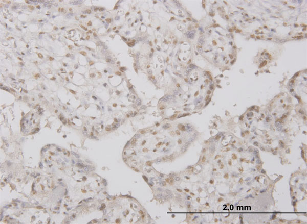 IHC - PPP1R2 Antibody (monoclonal) (M01) AT3409a