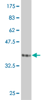 WB - PPP1R2 Antibody (monoclonal) (M01) AT3409a
