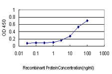 E - PSCD1 Antibody (monoclonal) (M01) AT3449a