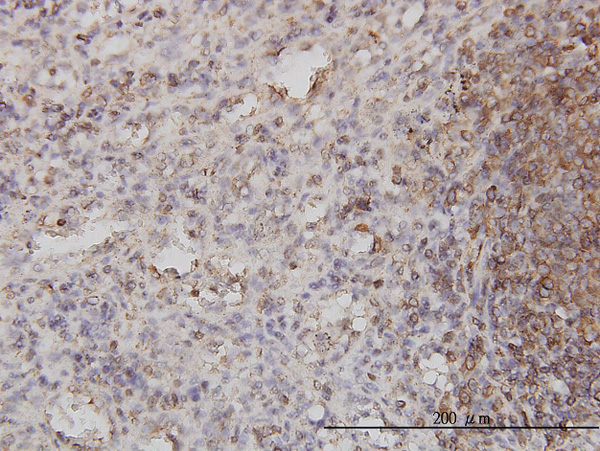 IHC - PSCD1 Antibody (monoclonal) (M01) AT3449a