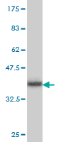 WB - PX19 Antibody (monoclonal) (M01) AT3504a