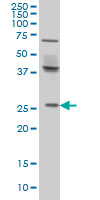 WB - PX19 Antibody (monoclonal) (M01) AT3504a