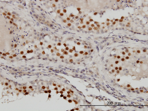 IHC - RACGAP1 Antibody (monoclonal) (M01) AT3542a
