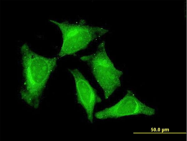 IF - RASGEF1C Antibody (monoclonal) (M01) AT3578a