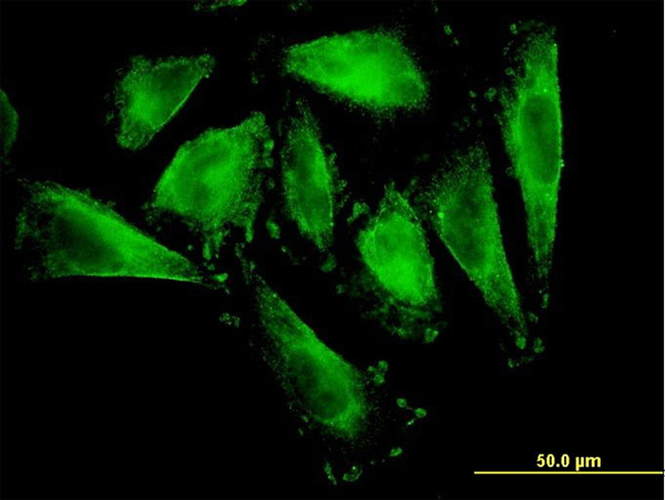 IF - RFNG Antibody (monoclonal) (M08) AT3623a