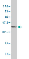 WB - RFNG Antibody (monoclonal) (M08) AT3623a