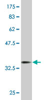 WB - SEP11 Antibody (monoclonal) (M02) AT3812a