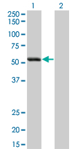 WB - SIGLEC6 Antibody (monoclonal) (M02) AT3887a
