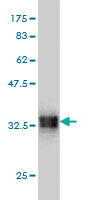 WB - SMOC1 Antibody (monoclonal) (M03) AT3961a