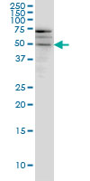 WB - SMOC1 Antibody (monoclonal) (M03) AT3961a