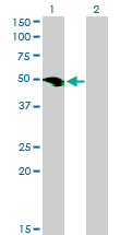 WB - SMOC1 Antibody (monoclonal) (M03) AT3961a