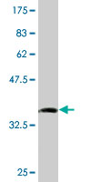 WB - SMPDL3B Antibody (monoclonal) (M01) AT3963a