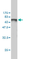 WB - SNX25 Antibody (monoclonal) (M01) AT3986a