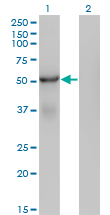 WB - SNX25 Antibody (monoclonal) (M01) AT3986a