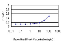 E - SOCS6 Antibody (monoclonal) (M01) AT3991a
