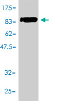 WB - SOCS6 Antibody (monoclonal) (M01) AT3991a