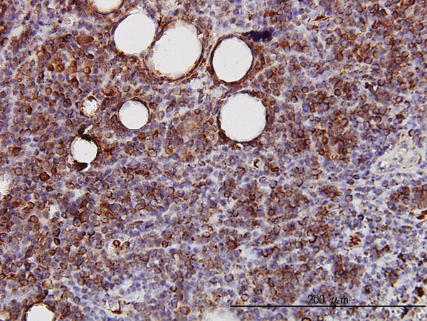 IHC - SPRY2 Antibody (monoclonal) (M01) AT4032a
