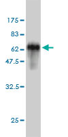 WB - SPRY2 Antibody (monoclonal) (M01) AT4032a