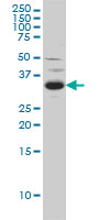 WB - SPRY2 Antibody (monoclonal) (M01) AT4032a