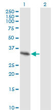 WB - SPRY2 Antibody (monoclonal) (M01) AT4032a