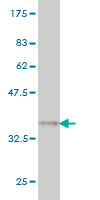 WB - SSBP3 Antibody (monoclonal) (M01) AT4044a