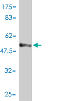 WB - STX6 Antibody (monoclonal) (M01) AT4099a